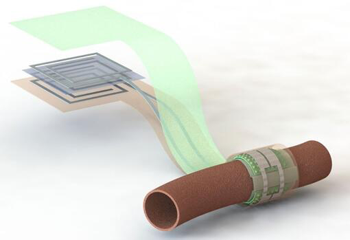 上圖描繪了這款可生物降解的壓力傳感器，它圍繞著一根血管，天線在左側(cè)(分離的層狀結(jié)構，展示了天線結(jié)構的細節(jié))
